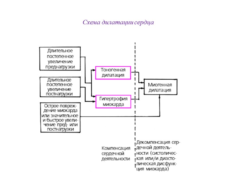 Схема дилатации сердца